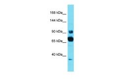 CCDC178 Rabbit anti-Human, Polyclonal, Novus Biologicals 0.1 mL | Buy Online | Novus Biologicals | Fisher Scientific